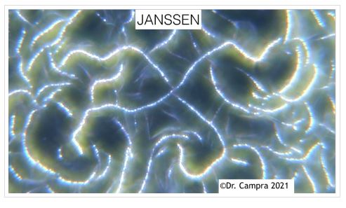 formations dans le Janssen