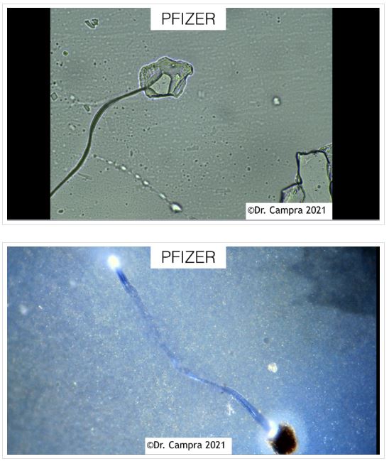 Nanoparticule inconnue dans le Pfizer