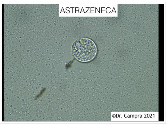 Astrazeneca