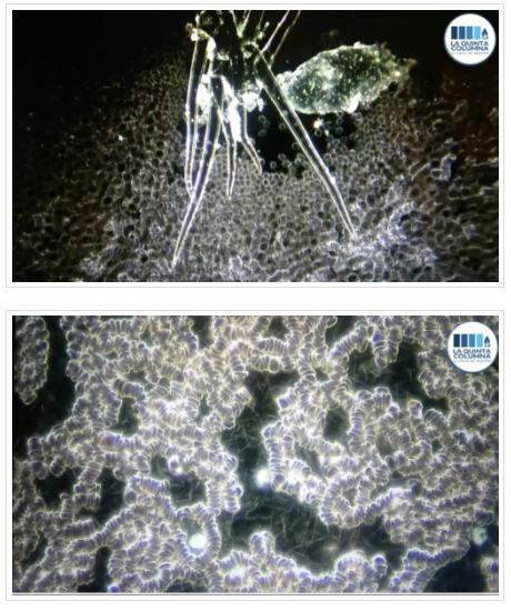 Parasite inconnu dans le sang
